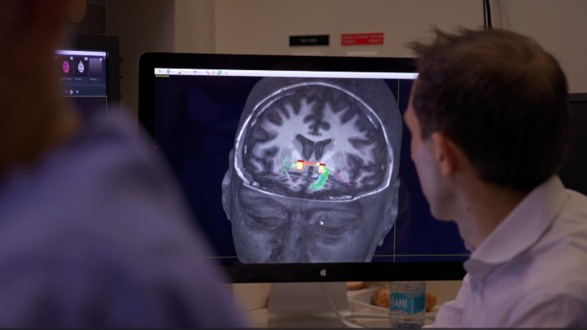 Researchers looking at a computer model of a brain